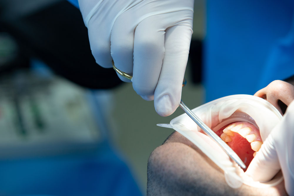 cirugia-mar-dental