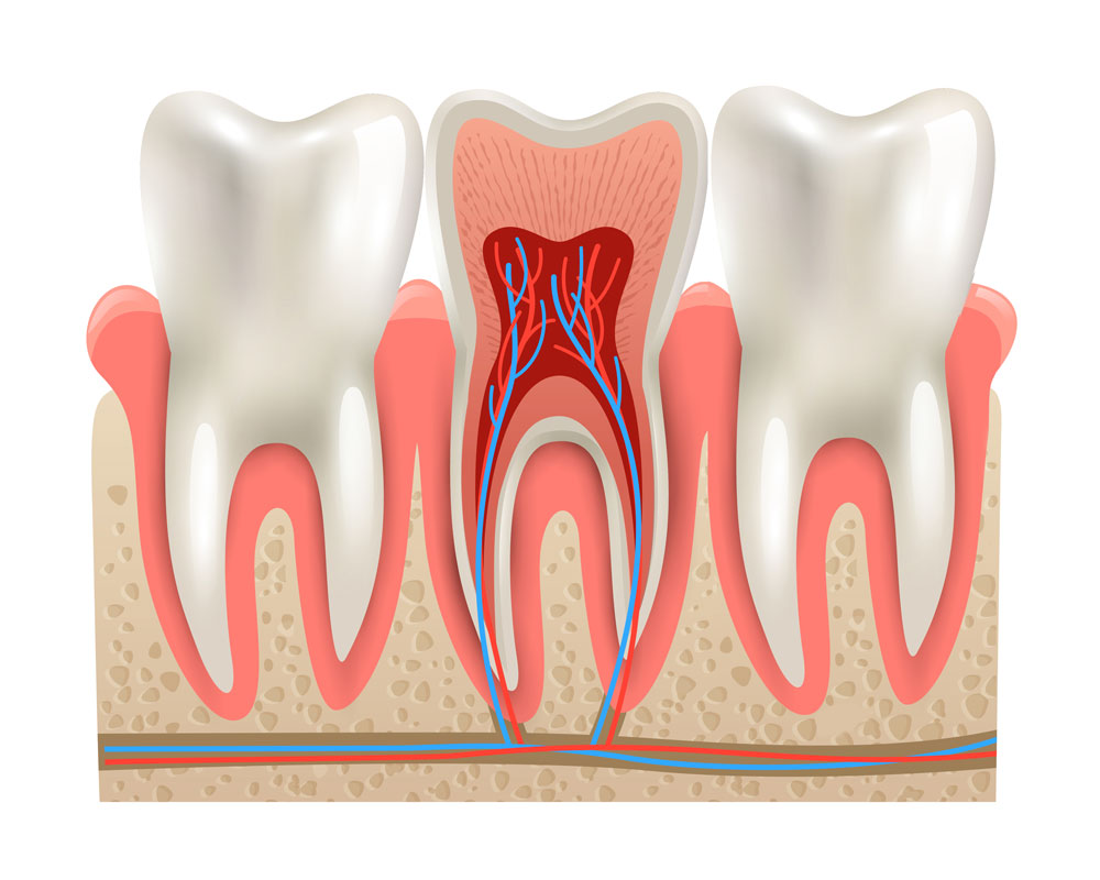 endodoncia