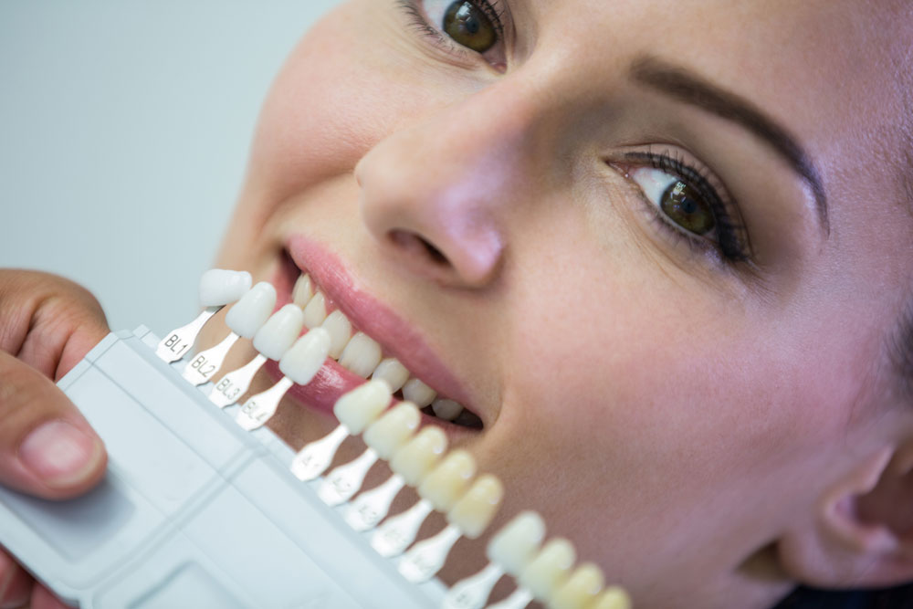 estetica-dental